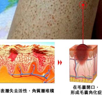 寶膚婗緊實修護精華乳